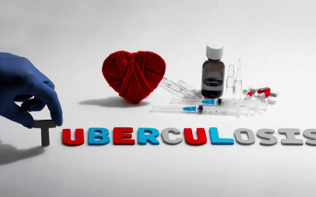 The Impact of Missed Childhood Tuberculosis. Cases on Global TB Control Goals