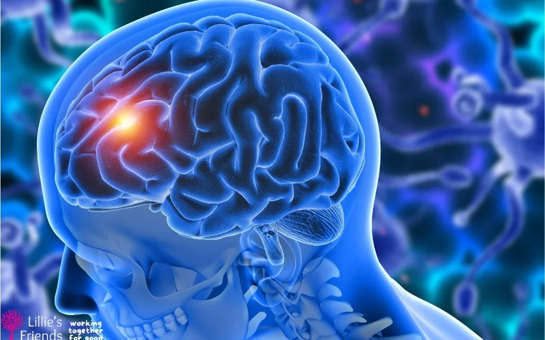 The Effects of Depression on Brain Activity